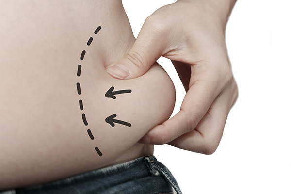 Love Handles Liposuction 