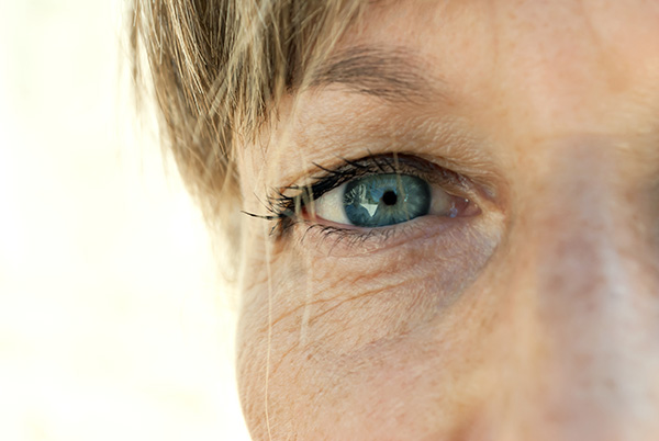 woman with lines around eyes